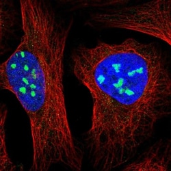 MPHOSPH10 Antibody, Novus Biologicals 25 &mu;L, Unlabeled:Antibodies, Polyclonal